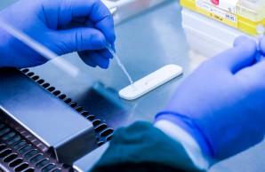 Antikörpertest 