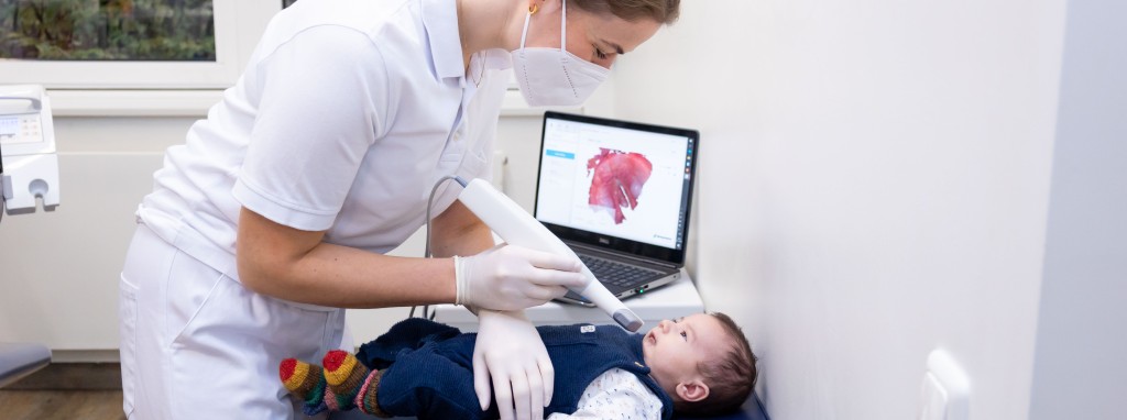 Baby mit Gaumenspalte