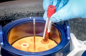 Analyse einer Blutprobe in einer Zentrifuge