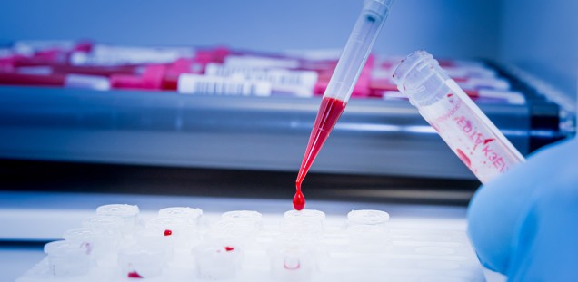 Pipettierung von Blutproben