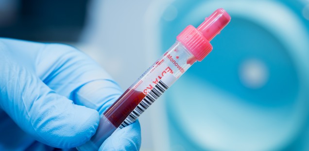 Ein Blutentnahmeröhrchen mit Blut zur weiteren Untersuchung