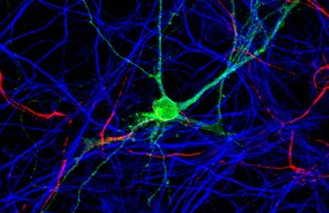 ZMNH Institut für Neuroimmunologie und Multiple Sklerose