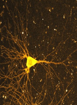 The function of endoplasmic reticulum (ER) in spines