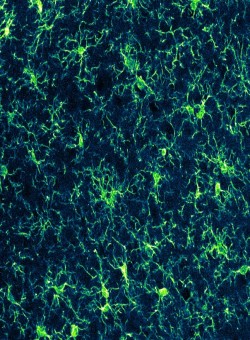 Interactions of microglia and neurons after stroke