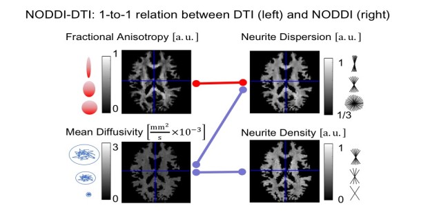 NODDI-DTI model 