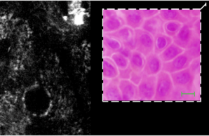 Multiphotonen tomographische Untersuchungen der Haut 