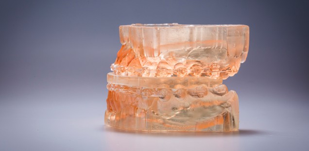  Bild eines 3D-gedruckten Gebiss mit orthognatischem Splint