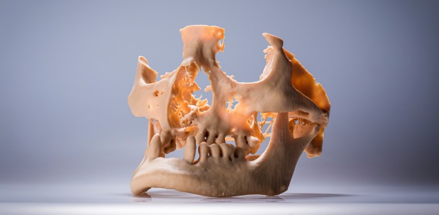  Bild eines 3D-gedruckten Schädels