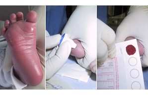 Laboratory services of the UKE - Metabolic laboratory and newborn screening